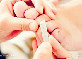 北派修脚（京广路店）