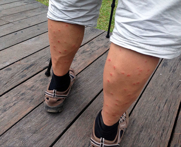 21在此 推荐碘酒消毒 再到台北药局中买一款叫 康之田 稳袂痛的药膏 只有这款止痒功效好 其它都不行 七星潭风景区 评论 去哪儿攻略