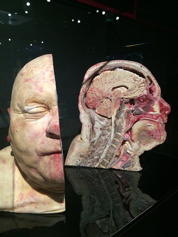 福尔马林浸泡人体图片