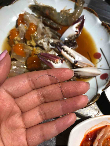 2万韩币120人民币打车费都不够更别说看牙科